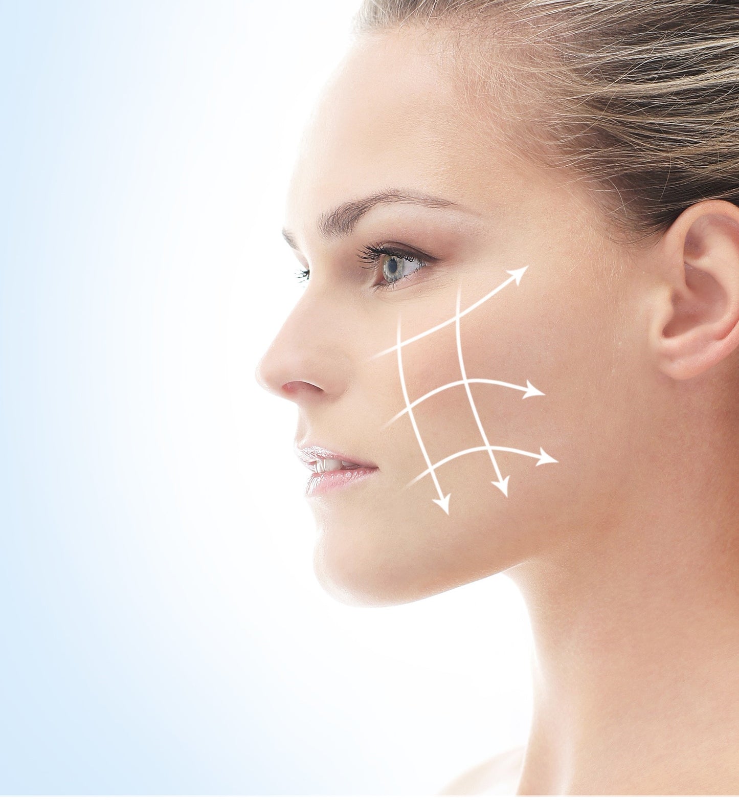 Lift-Me Dermal Filler Bundle