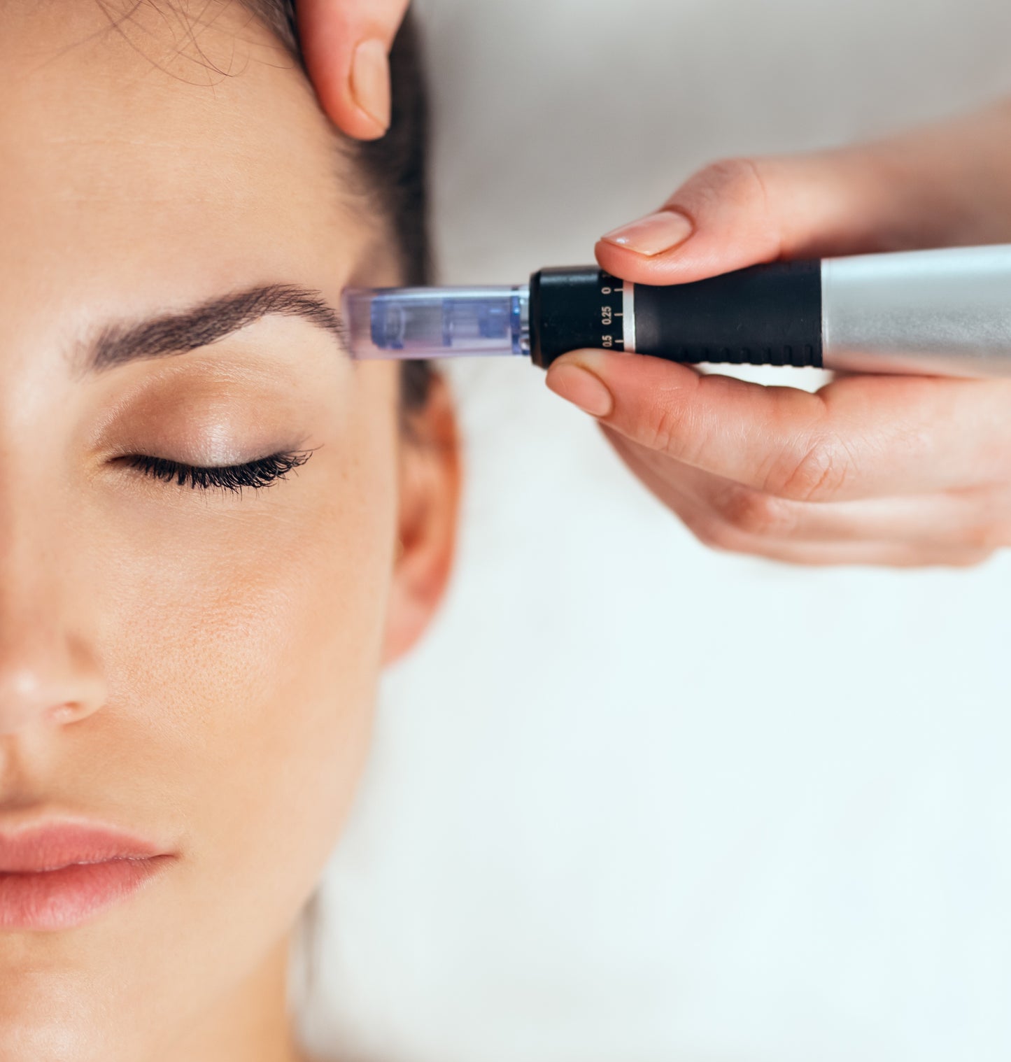 PRP/PRF with Microneedling