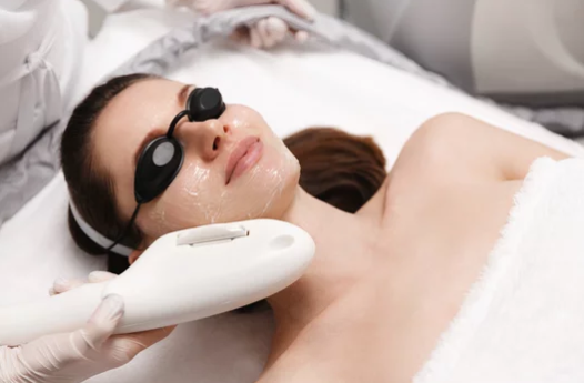 Lumecca IPL Photofacial