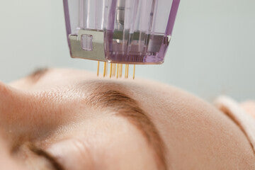 EXO-Xom + Microneedling Bundle